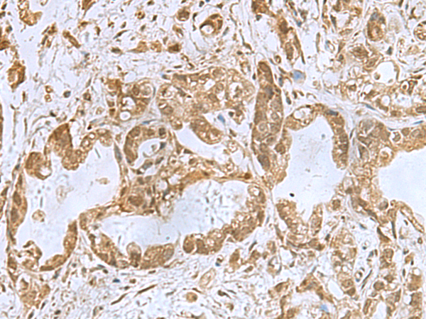 Rabbit Polyclonal Antibody to PHF6