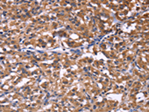 Rabbit Polyclonal Antibody to SELPLG