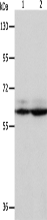 Rabbit Polyclonal Antibody to PSMD3