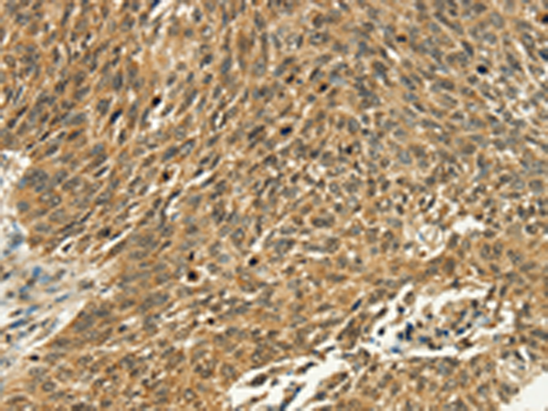 Rabbit Polyclonal Antibody to PSMD10