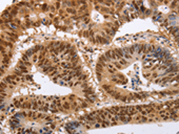 Rabbit Polyclonal Antibody to PSMD8