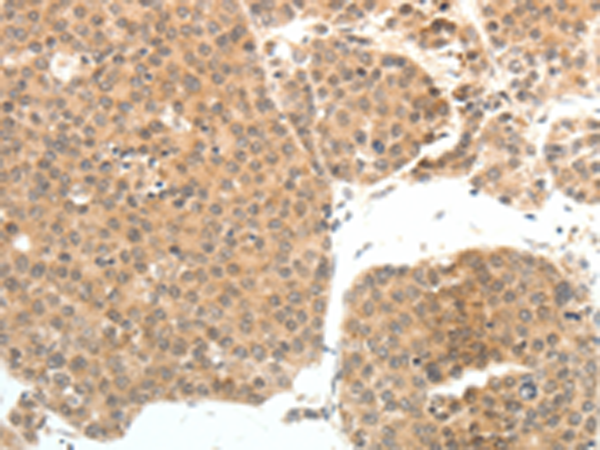 Rabbit Polyclonal Antibody to PSMD7