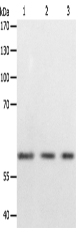 Rabbit Polyclonal Antibody to PSMD3