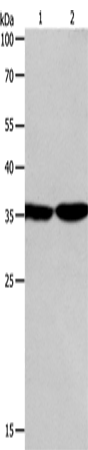 Rabbit Polyclonal Antibody to PSMD14