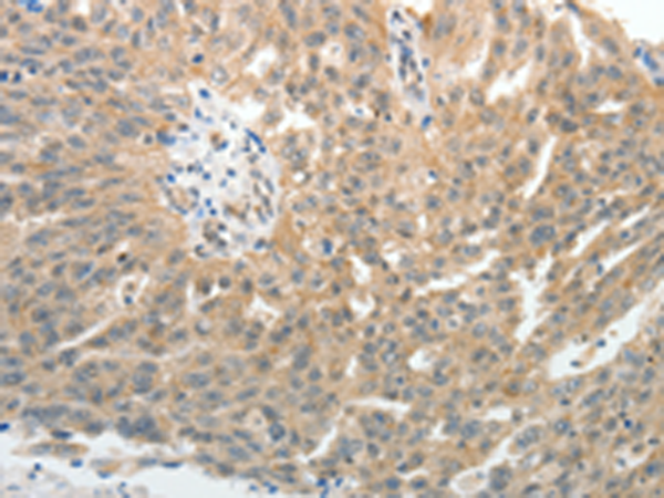 Rabbit Polyclonal Antibody to SELE