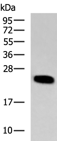 Rabbit Polyclonal Antibody to PTGDS