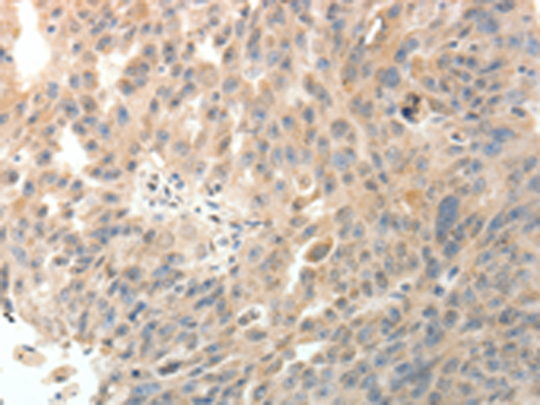 Rabbit Polyclonal Antibody to PTHLH