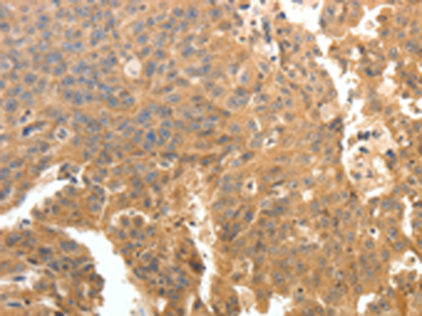 Rabbit Polyclonal Antibody to PTPRE