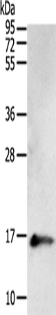 Rabbit Polyclonal Antibody to PVALB