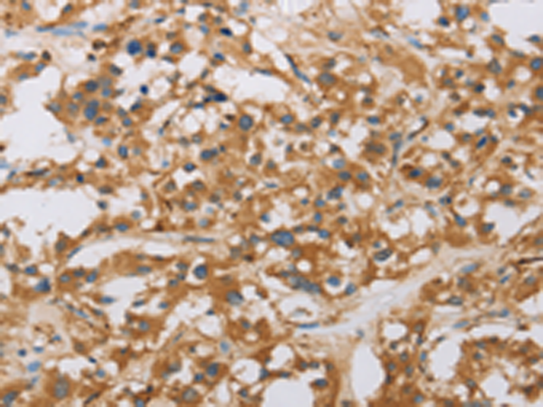 Rabbit Polyclonal Antibody to RAD54L2