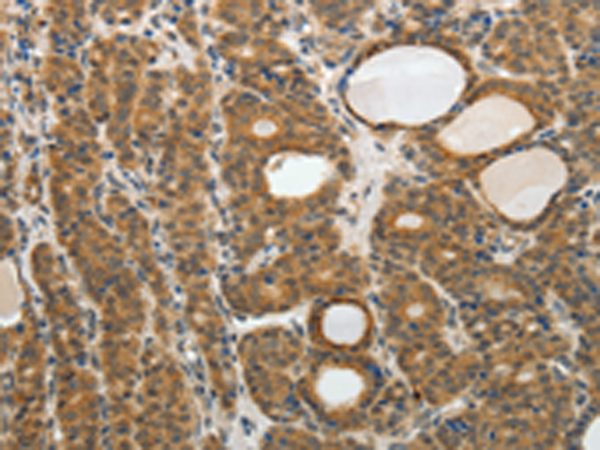Rabbit Polyclonal Antibody to RARA