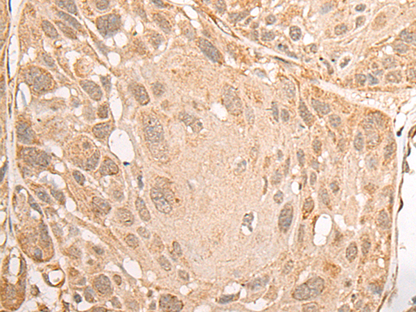 Rabbit Polyclonal Antibody to RBMS2