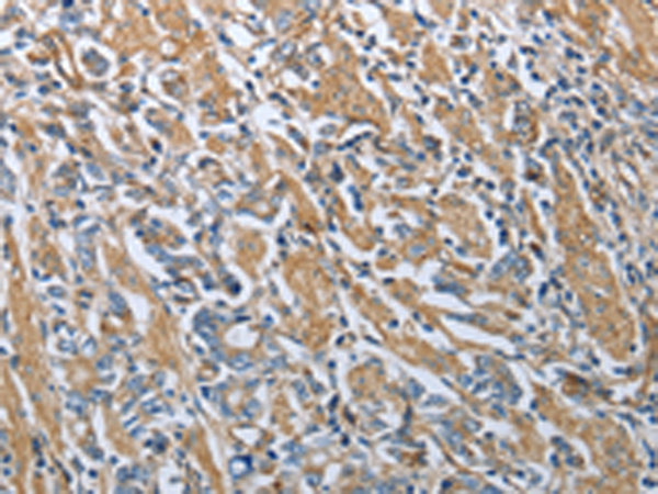 Rabbit Polyclonal Antibody to RETN