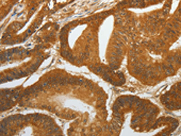 Rabbit Polyclonal Antibody to RETNLB