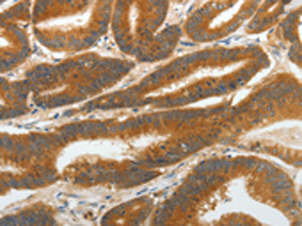 Rabbit Polyclonal Antibody to RGS2