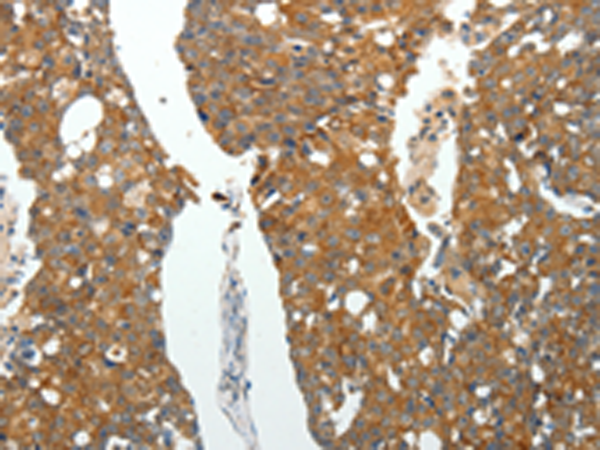 Rabbit Polyclonal Antibody to ROCK1
