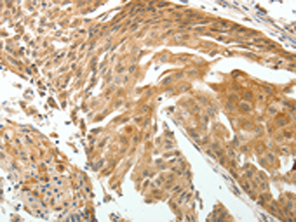 Rabbit Polyclonal Antibody to ROCK2