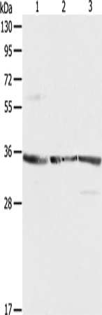 Rabbit Polyclonal Antibody to RPLP0