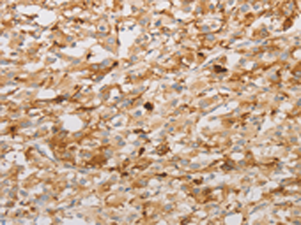 Rabbit Polyclonal Antibody to S100A1