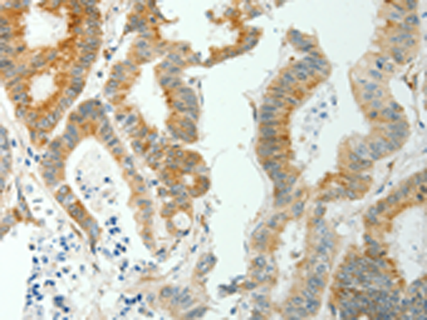 Rabbit Polyclonal Antibody to SELENOM
