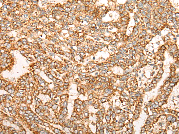 Rabbit Polyclonal Antibody to NR0B2