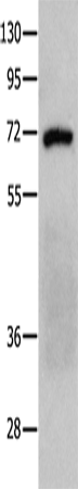 Rabbit Polyclonal Antibody to PTPN11