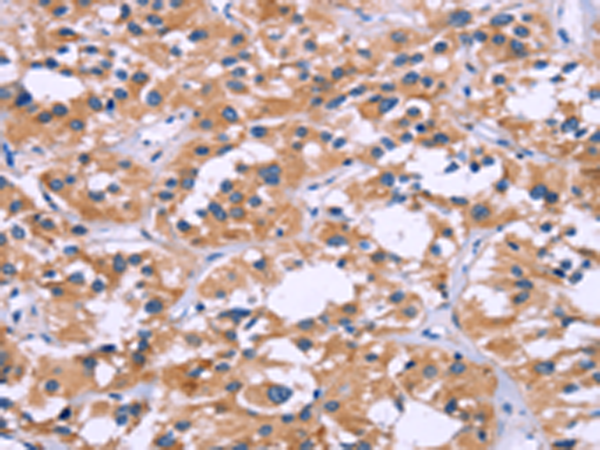 Rabbit Polyclonal Antibody to ZEB2