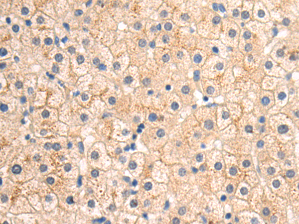 Rabbit Polyclonal Antibody to SIRT3