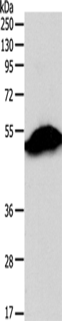 Rabbit Polyclonal Antibody to SIRT6