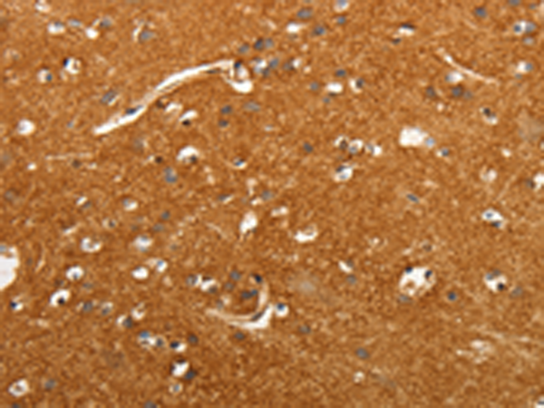 Rabbit Polyclonal Antibody to SLC4A4