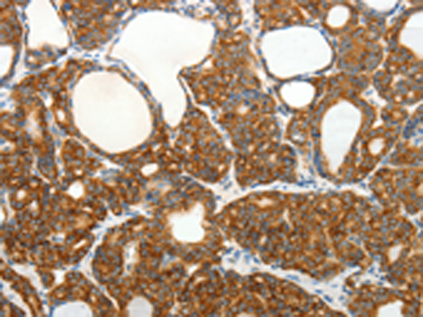 Rabbit Polyclonal Antibody to SLC12A4