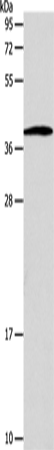 Rabbit Polyclonal Antibody to SLC25A11