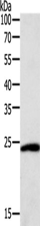 Rabbit Polyclonal Antibody to SNAP25
