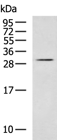 Rabbit Polyclonal Antibody to SNAI1