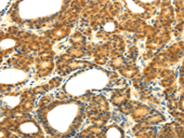 Rabbit Polyclonal Antibody to SOCS5