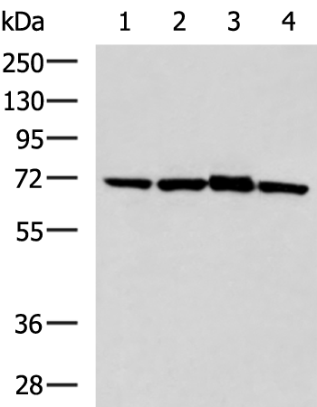 Rabbit Polyclonal Antibody to SOCS6