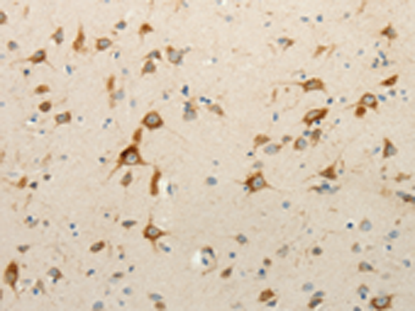 Rabbit Polyclonal Antibody to RPAP3