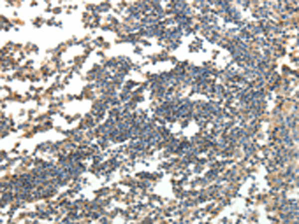 Rabbit Polyclonal Antibody to SPAG8