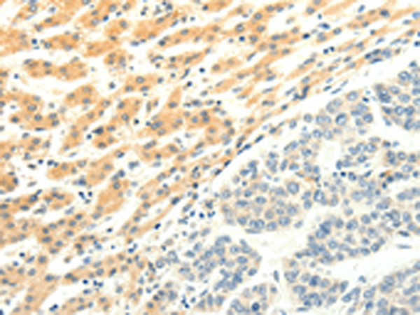 Rabbit Polyclonal Antibody to SPAG5