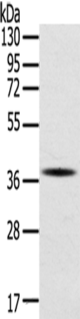 Rabbit Polyclonal Antibody to SPARC