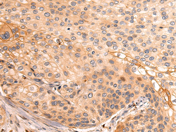Rabbit Polyclonal Antibody to SFTPC