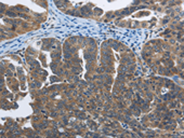 Rabbit Polyclonal Antibody to SYT3