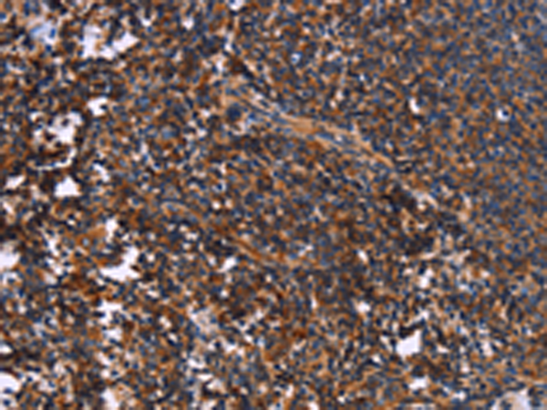 Rabbit Polyclonal Antibody to SYT4