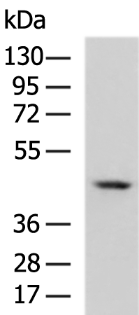 Rabbit Polyclonal Antibody to SYT5