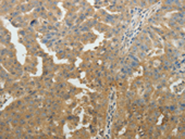 Rabbit Polyclonal Antibody to SYT6