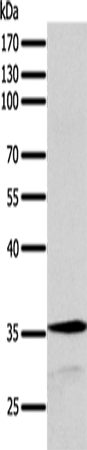 Rabbit Polyclonal Antibody to SYT9