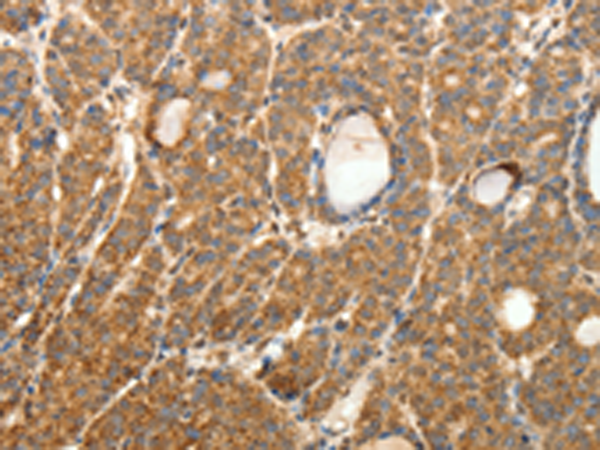 Rabbit Polyclonal Antibody to SYT11
