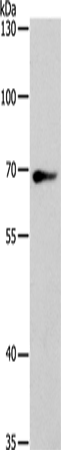 Rabbit Polyclonal Antibody to SPATA13