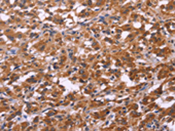 Rabbit Polyclonal Antibody to SPATA7