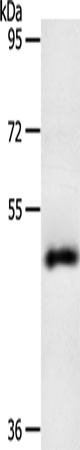 Rabbit Polyclonal Antibody to SPATA17